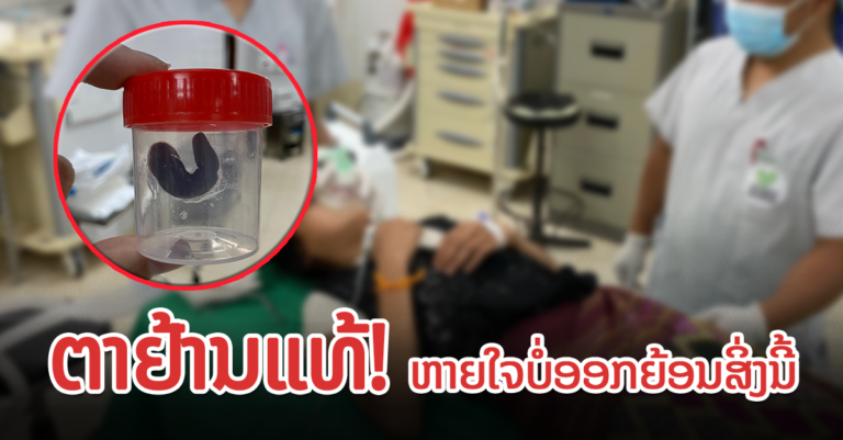 ພົບສິ່ງນີ້ຢູ່ໃນທໍ່ທາງເດີນອາຫານ ເຊິ່ງມາຈາກການດື່ມນໍ້າທີ່ບໍ່ສະອາດ